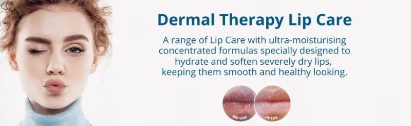 Dermal Therapy Lip Balm Original Tube 10g/each Hydrate & Soften Severely Dry Lip