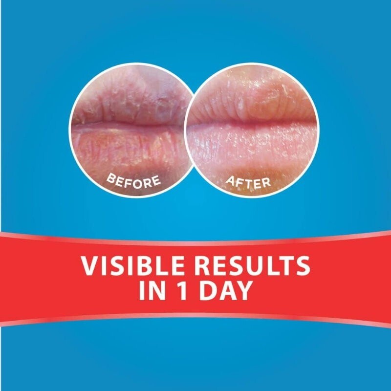 Dermal Therapy Lip Balm Original Tube 10g/each Hydrate & Soften Severely Dry Lip