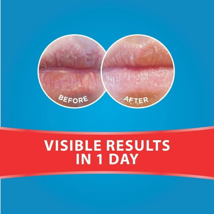Dermal Therapy Lip Balm Original Tube 10g/each Hydrate & Soften Severely Dry Lip