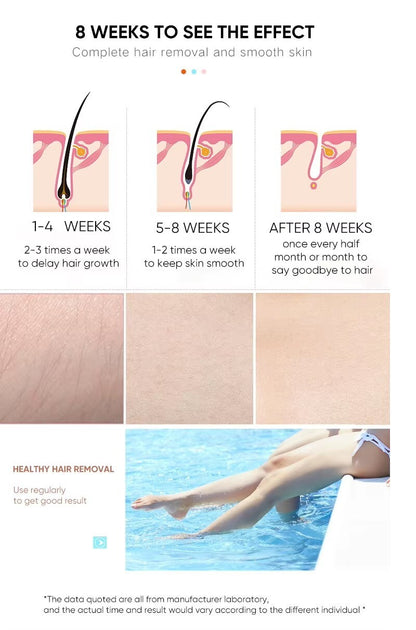 BoSidin IPL Laser Facial & Body Painless Permanent Hair Removal for Women & Men